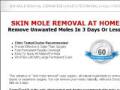 skin mole removal |