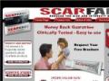 Scar removal gel - s